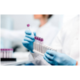 exame toxicológico para motorista Boa Vista II